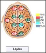 High left alpha magnitude with depression